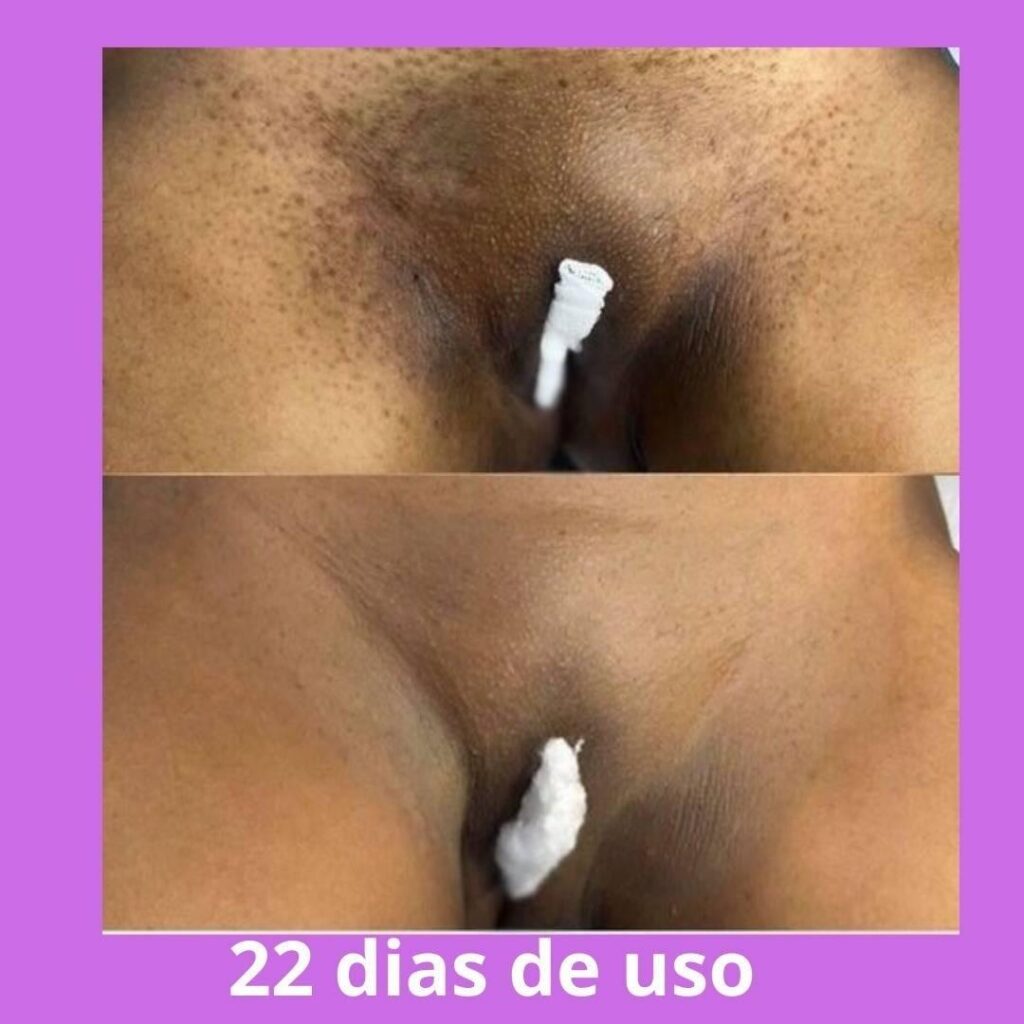 Imagem do WhatsApp de 2025-04-11 à(s) 13.28.14_de1fea19